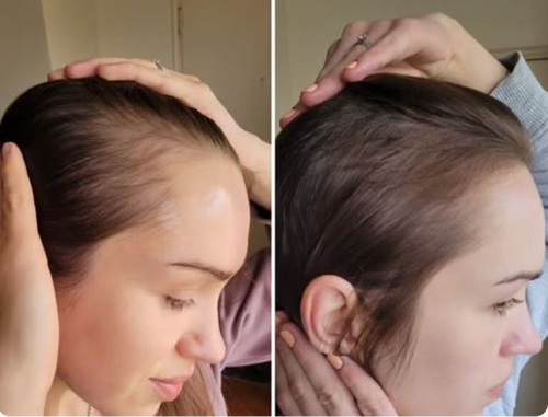 Saved My Hair from Falling Out